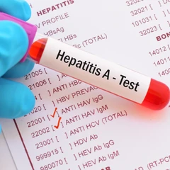 Pemeriksaan Hati (Anti HAV IgM/Hepatitis A) di FastMed