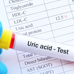 Pemeriksaan Asam Urat di FastMed