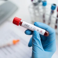 Pemeriksaan Anti HIV di FastMed