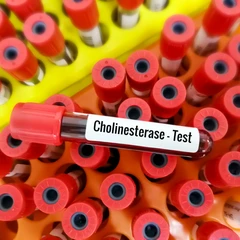 Pemeriksaan Cholinesterase (CHE) di FastMed