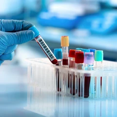Pemeriksaan Hati (HBsAG/Hepatisis B Rapid Test) di FastMed