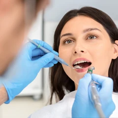 Tambal Gigi Komposit Besar di Klinik Surya Medika