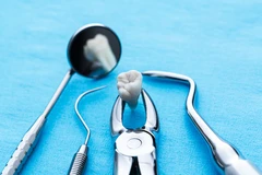 Cabut Gigi di Adore Dental Clinic