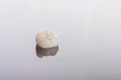 Mahkota Sementara untuk Veneer di Mydentismile