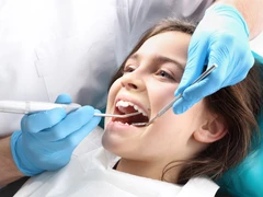 Komposit Posterior (Gigi Belakang) di Mydentismile