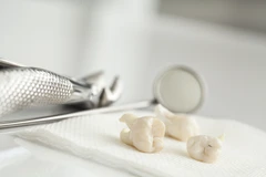 Reparasi Gigi Palsu di Mydentismile