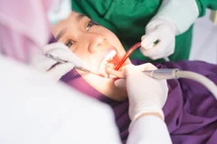 Cabut Gigi Bungsu (Odontektomi) Kelas 1 di Cling Dental Clinic