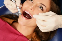 Kuretase di Cling Dental Clinic