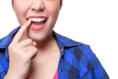 Kawat Niti Clear RA&RB di Cling Dental Clinic