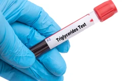 Pemeriksaan Trigliserida di ScanMe Labs