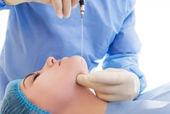 Botox Full Face di Zahira Skincare Clinic