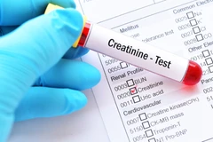 Pemeriksaan Creatinin di Klinik Ammyn Sukabumi