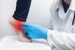 Fisioterapi Plantar Fasciitis di Physio Medical Clinic