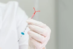 Pemasangan IUD TCU di Beta Health Care