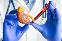 Pemeriksaan Fungsi Ginjal: Early Screening Advanced di Klinik Indrajana