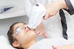 HIFU di Klinik Ozthetique Jakarta