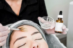 Deep Chemical Peeling for Melasma di Klinik Ozthetique Jakarta