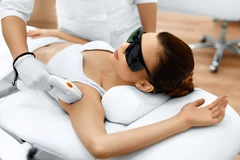 IPL Hair Removal Armpit di YLA by dr. Sylvienia