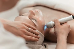 Lifting Facial V-Shaped di YLA by dr. Sylvienia