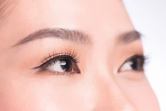 Laser Eye Bag 4D Smooth Eyelase di KLINIK E3A