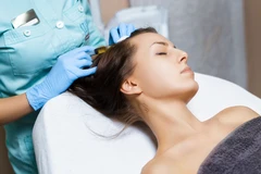 Hair Regrowth PRP di Amnion Clinic