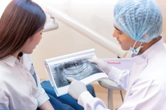 Rontgen Panoramic di Ada Dokter Gigi