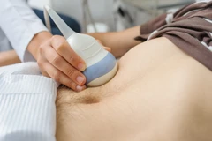 USG Whole Abdomen di Laboratorium Prodia