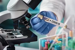 Thyroid Blood Check (3 Tes) di Klinik Lamonte