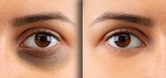 Puro Eyes For Wrinkles Solution di Puro Clinic