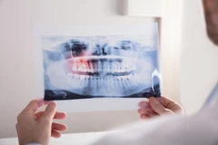 Rontgen Cephalometry 2D di CS Dental