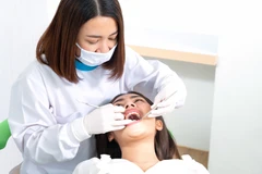 Cabut Gigi Permanen di CS Dental