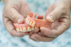 Gigi Palsu Thermosense Plat di CS Dental