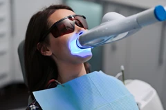 Bleaching Gigi dengan LED di Shiny Smile Dental
