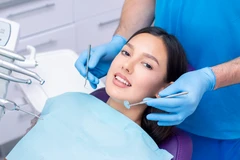 Veneer (Per gigi) di Drg. Leony Ricci