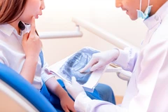 Gigi Palsu Plat Flexible di Umma Dental