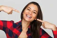 Pasang Behel Keramik di Halo Dentist
