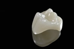 Cabut Gigi Bungsu Sederhana Dengan Drg Umum di Saja Dental