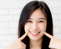 Gingivectomy/Potong Gusi Per Gigi oleh drg. Umum di Passion Dental Care