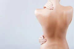 Soft Cauter per Titik di Indria Beauty