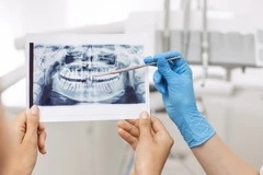 Rontgen Panoramic di Embun Galaxi Dental Care
