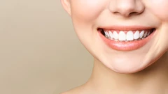 Indirect Veneer di The Clinic Beautylosophy