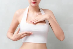 Reuvenation Breast di The Clinic Beautylosophy