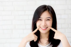 Pasang Basic Clear Aligners oleh drg. Umum + Scaling dan Polishing + Cetak Gigi di Dentalmate Dental Care Bekasi