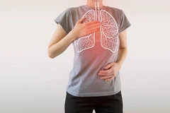 Tes Tuberculosis Rapid (IgM & IgG) di Klinik Vita Sehat
