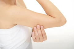 Full Arm Peeling (6x treatment) di Aetozee Aesthetic