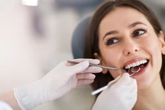 Pencabutan Gigi Tetap Simple (GP) di Klinik MedicaPro