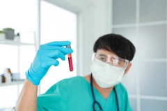 Pemeriksaan Immunologi Serologi Anti CCP Antibodi di ScanMe Labs
