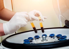 Pemeriksaan Faeces Fecal Calprotectin di ScanMe Labs