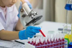 Pemeriksaan Hormon Thyroid Anti Mulerien Hormon (AMH) di ScanMe Labs