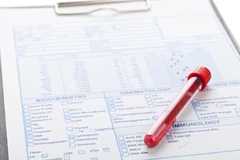 Screening Hepatitis di NMC Clinic & Laboratory